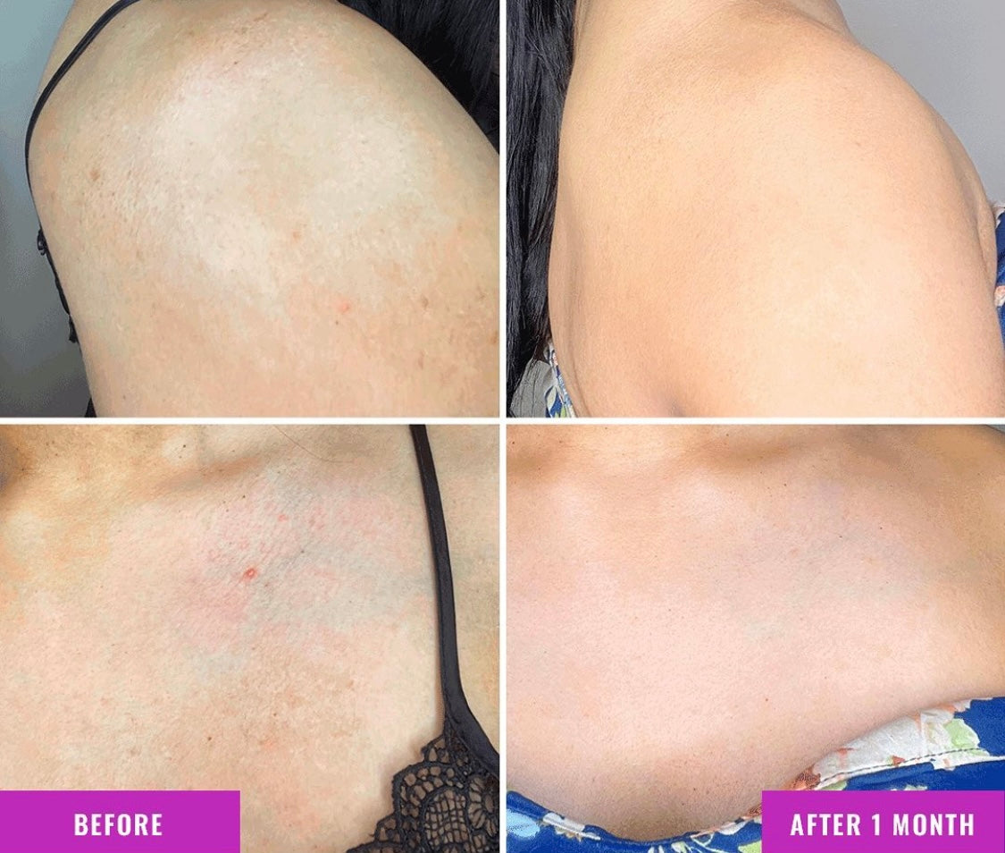 Good Molecules Discoloration Correcting Body Treatment